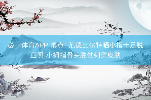 必一体育APP 慎点! 范德比尔特晒小指十足脱臼照 小拇指骨头胜仗刺穿皮肤